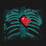 Рентгенография сердца в клетке